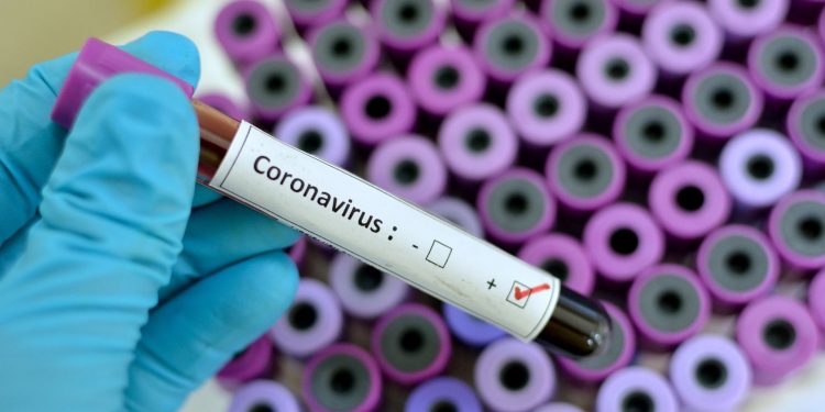 China, US spar over origin of coronavirus